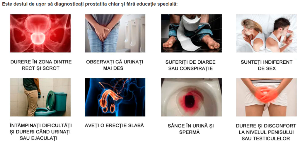 Uromexil Forte RO